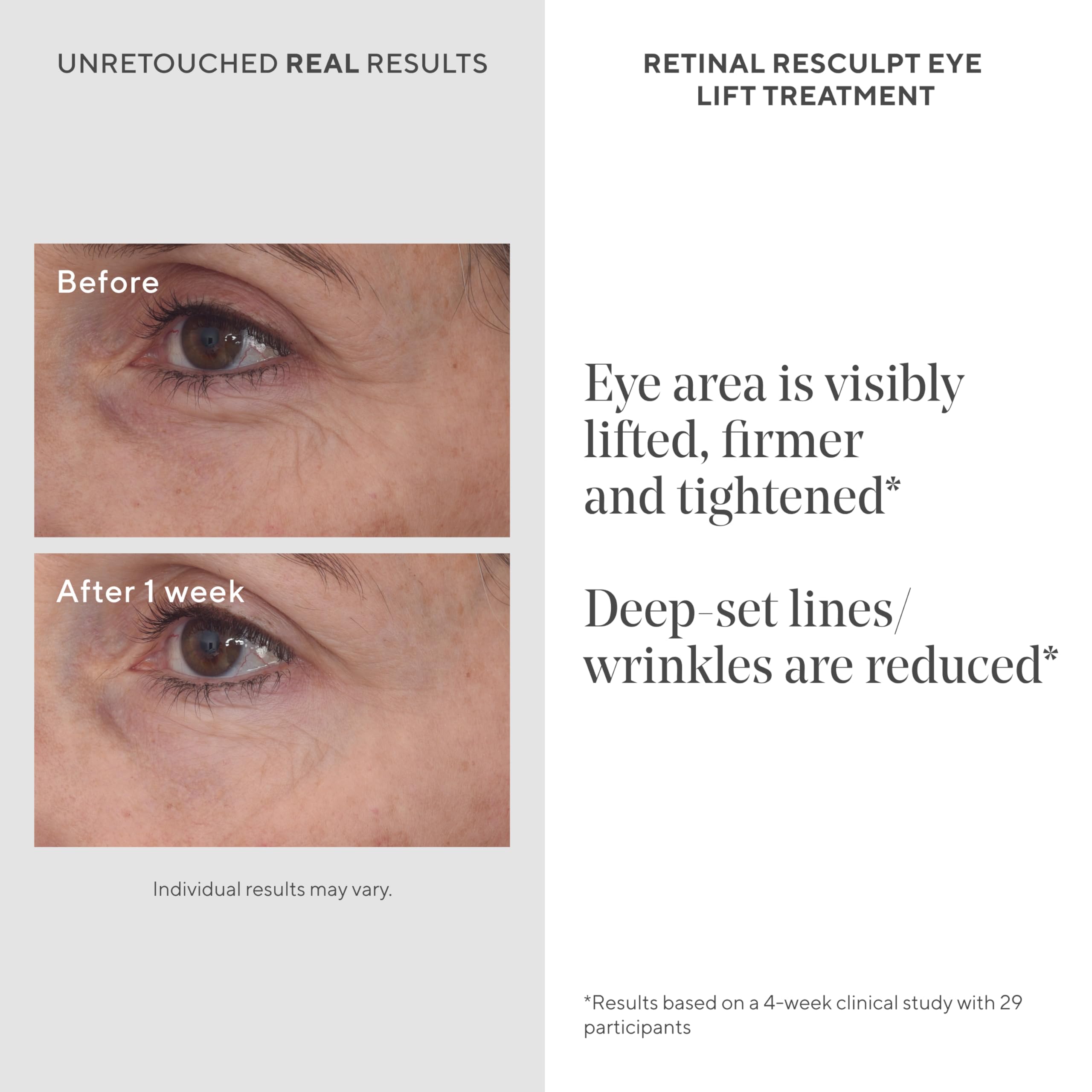 Murad Retinal ReSculpt Eye Lift Treatment - Anti-Aging Eye Cream Lifts and Improves Sagging - Encapsulated Vitamin A Eye Care Firms Droopy Eyelids, Reduces Lines and Wrinkles - 0.5 FL OZ